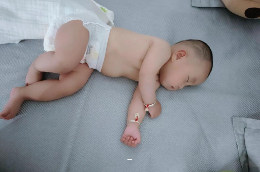 陆丰宝宝脸上有白色斑块